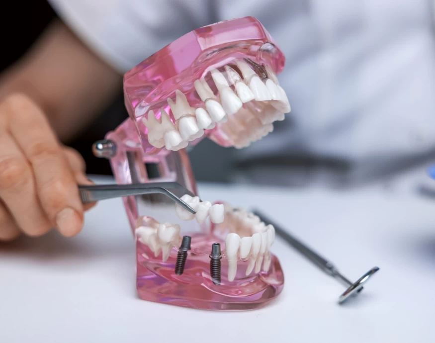 dental-services