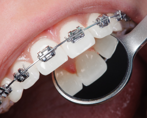 orthodontics2