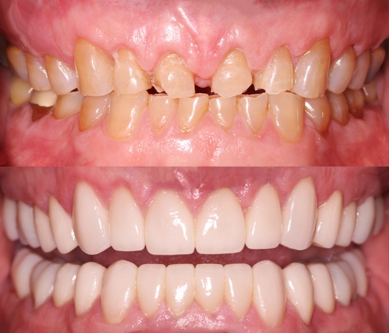 Restored Confidence after treatment